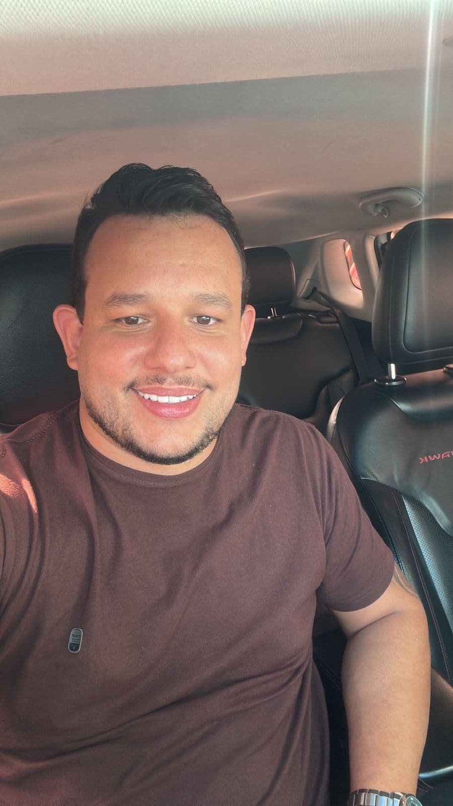 Facetas e lentes de contato dental — depois do tratamento